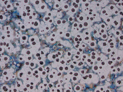 GB/T 9441-2021 球墨铸铁金相检验